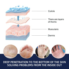 Anti-Drying Crack Hand Foot Care Cream Heel Cracked Repair Products Removal Dead Skin Moisturizing Whitening Nourish Skin Care