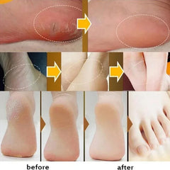 Moisturizing Anti-Drying Crack Foot Cream Hand Feet Care For Family Exfoliation Dead Skin Removal Softening Smooth Skin Cream