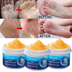 Anti-Drying Crack Hand Foot Care Cream Heel Cracked Repair Products Removal Dead Skin Moisturizing Whitening Nourish Skin Care