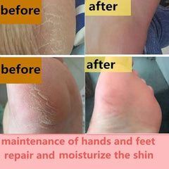 Moisturizing Anti-Drying Crack Foot Cream Hand Feet Care For Family Exfoliation Dead Skin Removal Softening Smooth Skin Cream