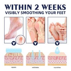 Anti-Drying Crack Hand Foot Care Cream Heel Cracked Repair Products Removal Dead Skin Moisturizing Whitening Nourish Skin Care