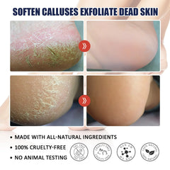 Anti-Drying Crack Hand Foot Care Cream Heel Cracked Repair Products  Removal Dead Skin Moisturizing Whitening Nourish Skin Care