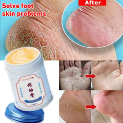 Moisturizing Anti-Drying Crack Foot Cream Hand Feet Care For Family Exfoliation Dead Skin Removal Softening Smooth Skin Cream